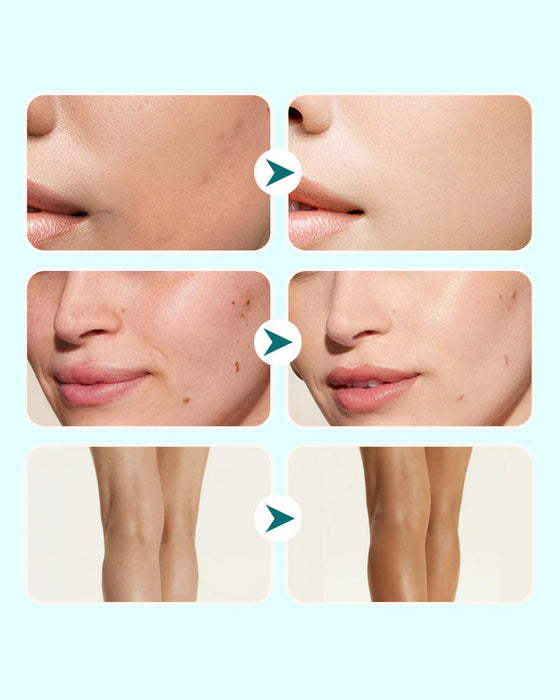 Alt-i-én Fugtgivende Concealer Vandtæt Creme Til Kvinder